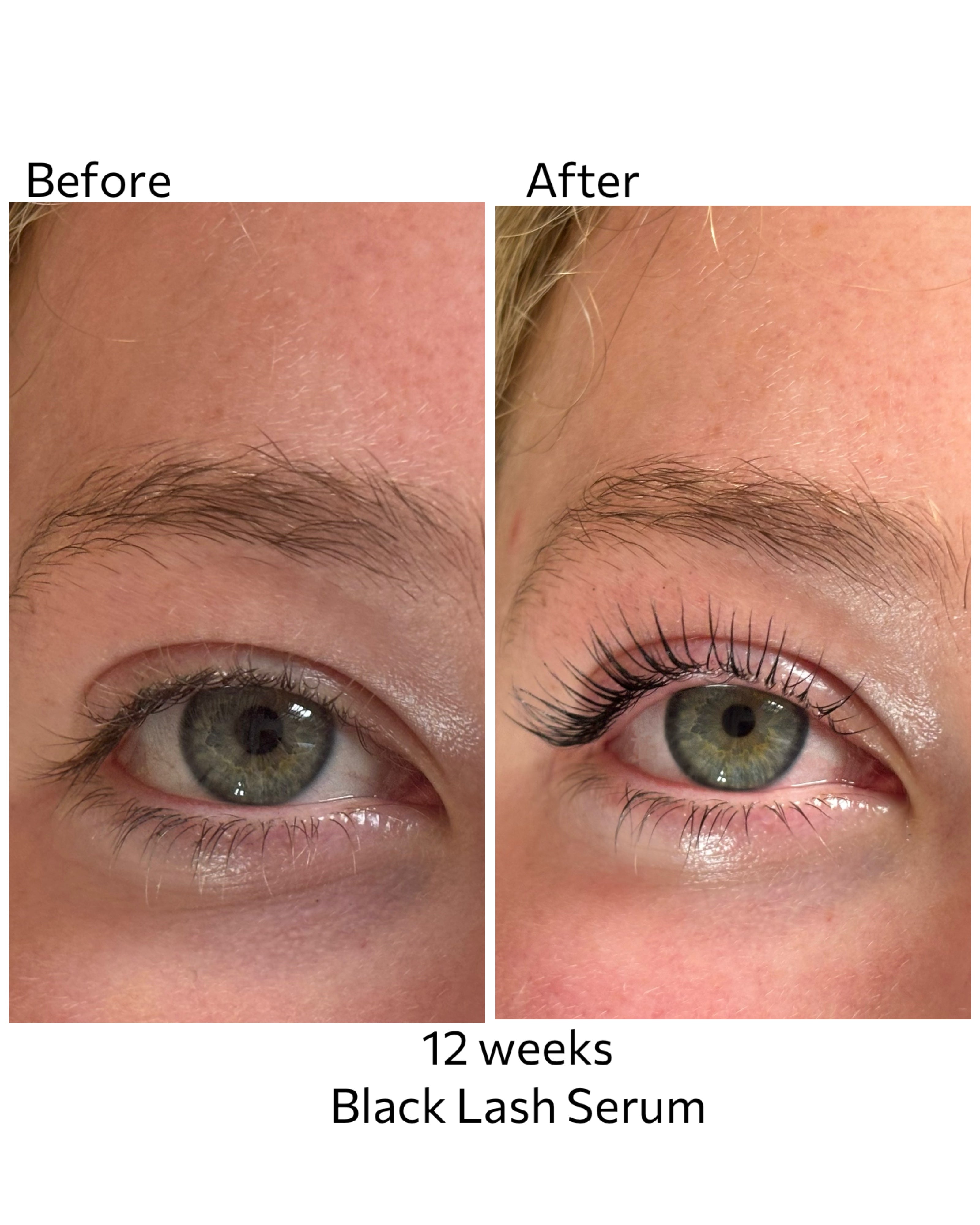 Black Lash Serum