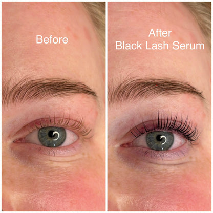 The Lash Upgrade Duo - Black Lash Serum + Tubing Mascara Serum