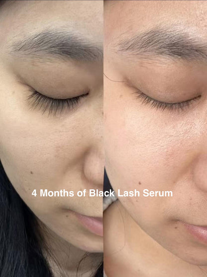 Black Lash Serum