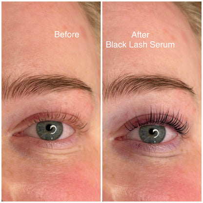 Black Lash Serum