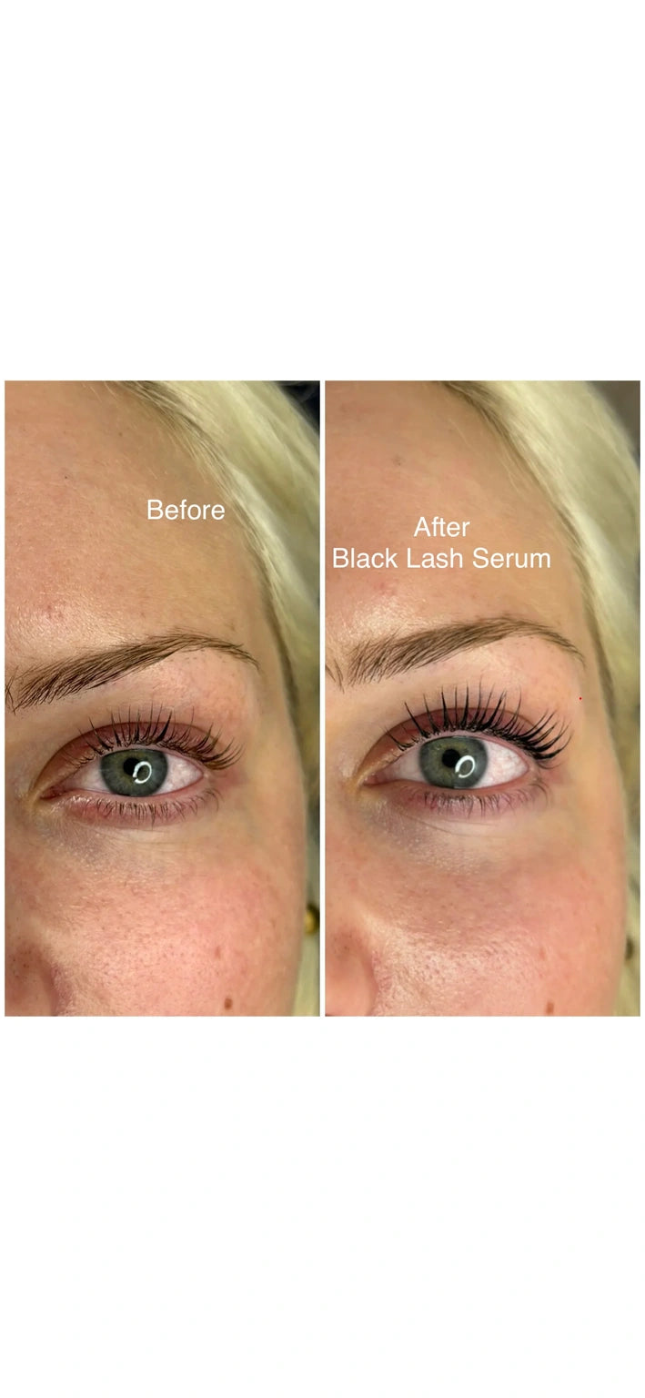 Black Lash Serum