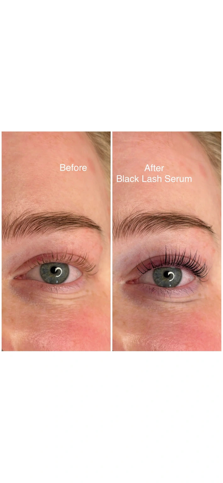 Black Lash Serum