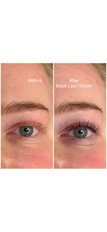 Black Lash Serum